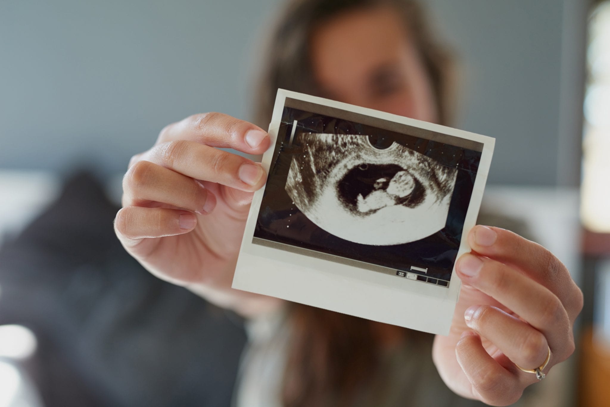 Gender & Foetal Wellbeing | From 16 – 18 Weeks