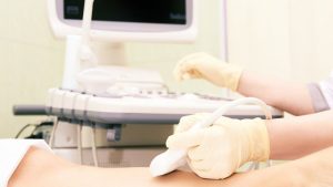 leg ultrasound for dvt