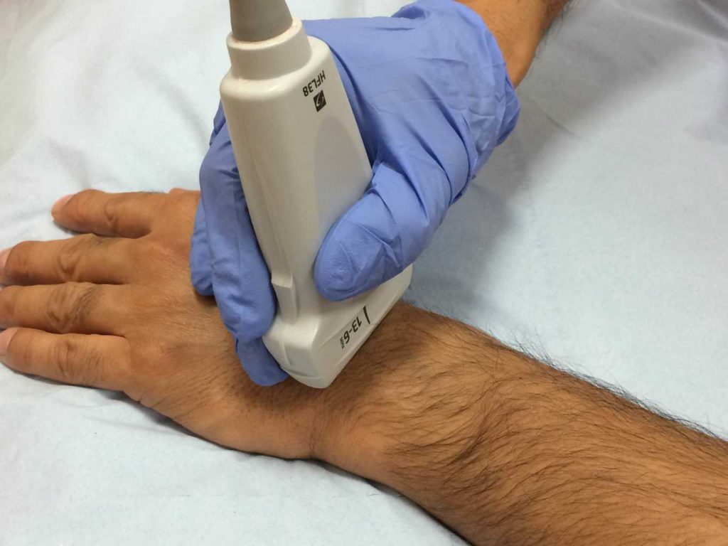 Hand and Wrist Ultrasound